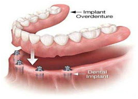 8dental