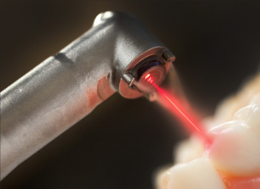 dental-laser2