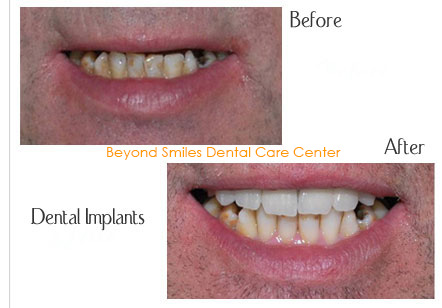 Beyond Teeth: What’s Inside Your Mouth