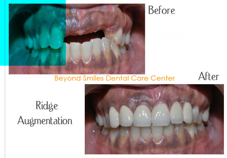 Beyond Teeth: What’s Inside Your Mouth