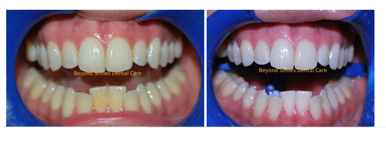 Beyond Teeth: What’s Inside Your Mouth