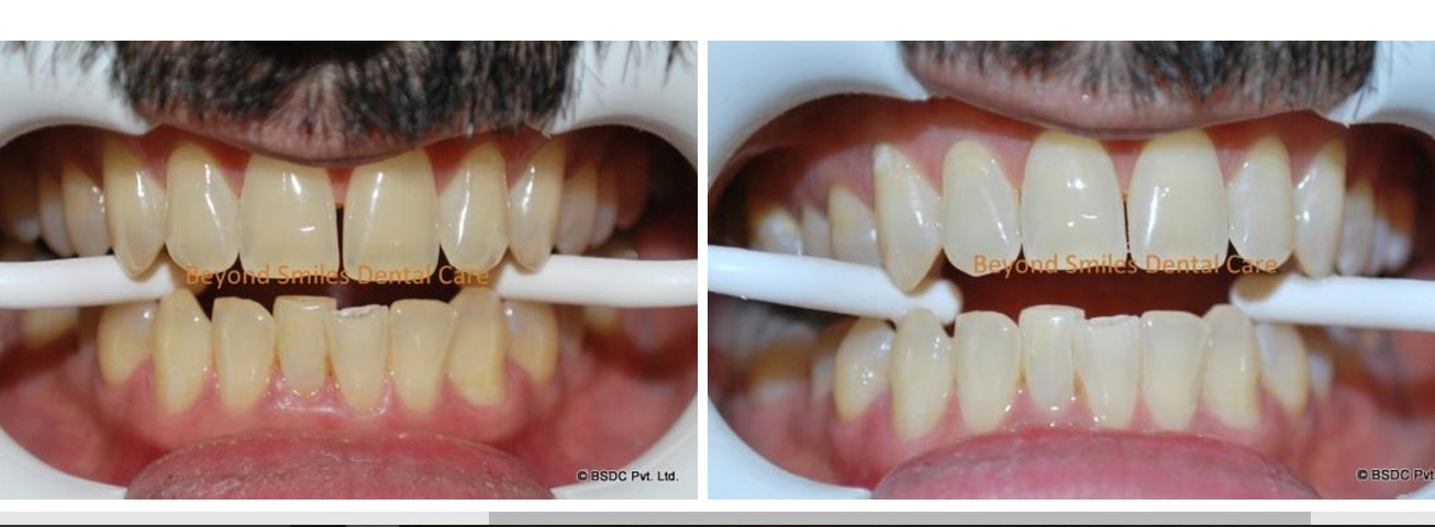 Beyond Teeth: What’s Inside Your Mouth