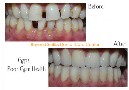 Beyond Teeth: What’s Inside Your Mouth